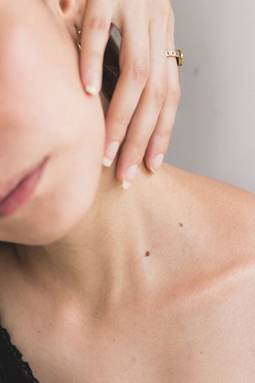 7 Natural and painless ways to remove blackheads